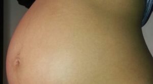 Protegido: mi barriguita