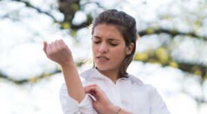 Primeros auxilios: cómo actuar ante una picadura de mosquito, abeja, medusa…