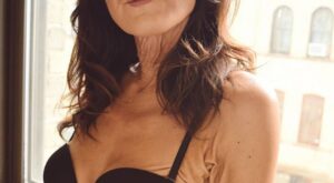 Tiene 26 años y una extraña enfermedad de la piel con la que nos da una lección de autoestima