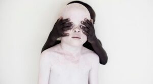 Estas preciosas fotografías muestran la otra cara de los albinos Tanzania