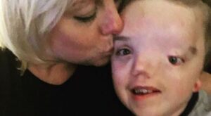 Instagram censura una foto de un niño enfermo y su madre responde así