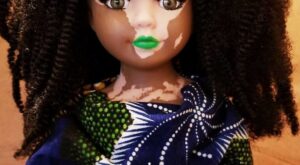 Una artista crea estas muñecas con vitíligo para ayudar a los niños con esta enfermedad