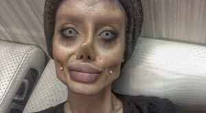 Esta chica se somete a 50 operaciones para parecerse a Angelina Jolie