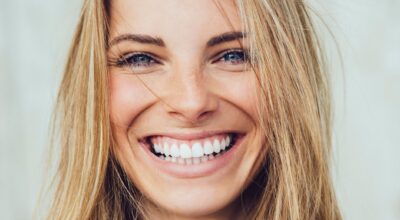 Estética de encías: los mejores tratamientos para presumir de sonrisa