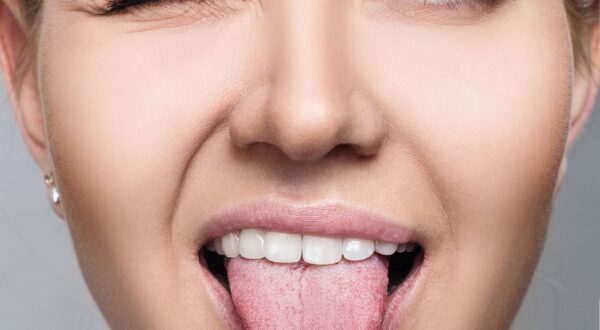 ¿Qué dice tu lengua sobre tu estado de salud?