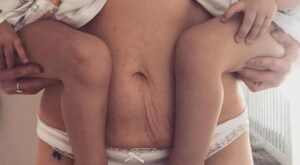 Esta cuenta de Instagram comparte las fotos postparto más honestas