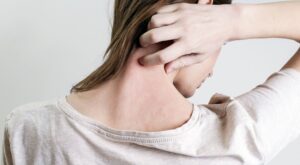 ¿Tienes la piel atópica? Estos son los productos imprescindibles para tratarla