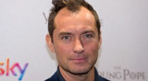 Famosos que se han hecho un transplante de pelo