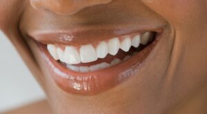 El vello en la barbilla no es solo una cuestión de estética, puede ocultar otros problemas