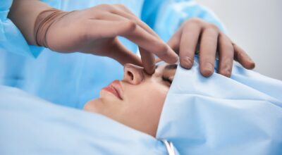 ¿Estás pensando en someterte a una rinoplastia? Esto es todo lo que debes saber
