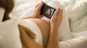 ¿En que consiste una ecografía 3D? Te contamos cuánto cuesta y cuándo debes realizarla