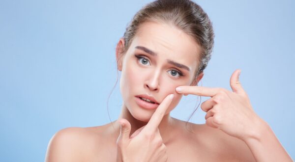 ¿Un grano en el peor momento? Hazlo desaparecer con estas cremas y di adiós al acné