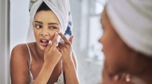 ¿Acabar por fin con los puntos negros y las espinillas? Sí, es posible