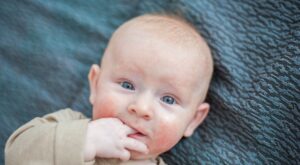 Todo lo que debes saber sobre el virus boca-mano-pie