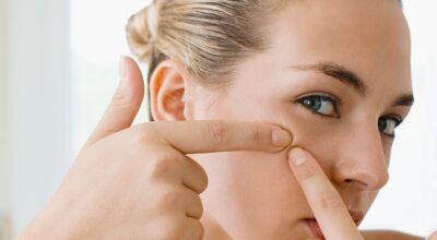 Cómo quitar puntos negros: los mejores consejos