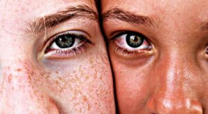 Crema para manchas en la cara: ¿qué formulas tienen eficacia probada?