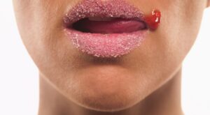 Exfoliante de labios: ¿por qué debes incluirlo en tu rutina?