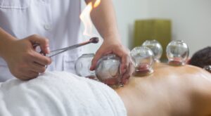 El cupping, uno de los tratamientos más requeridos por los deportistas