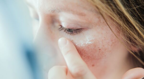 Granitos debajo de la piel: ¿por qué ocurre y cómo tratarlos?