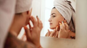 Quistes de Milia: qué son, por qué aparecen y cómo eliminarlos