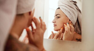 Quistes de Milia: qué son, por qué aparecen y cómo eliminarlos