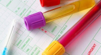 Aprende a interpretar un análisis de sangre