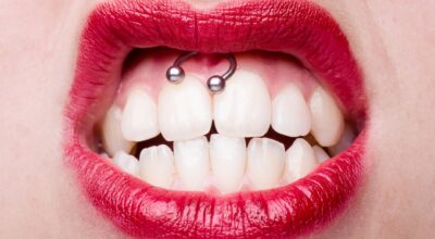 El piercing Smiley: ¿duele realmente tanto como dicen?