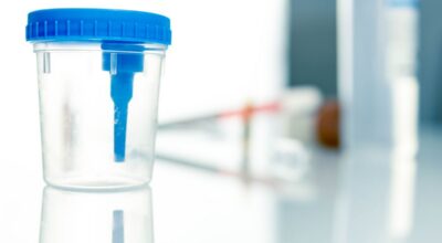 Estudios recientes sugieren que el cáncer de endometrio podría detectarse con un análisis de orina