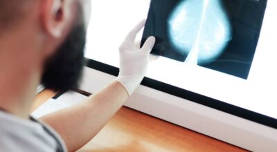 Mamografías con IA detectan el cáncer de mama un 20% más según un estudio