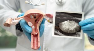 Salud femenina y metales pesados: Estudio revela conexiones alarmantes con la fertilidad