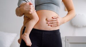 Cesárea: ¿Dolor eterno? Descubre por qué la cicatriz te sigue molestando