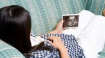 ¡Bebé de piedra! Fallece mujer tras 30 años con un feto calcificado en su vientre