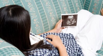 ¡Bebé de piedra! Fallece mujer tras 30 años con un feto calcificado en su vientre