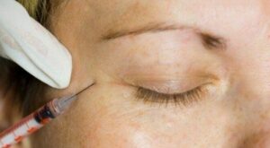 Eliminar las arrugas