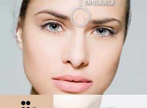 FC Facial CLINIQUE + la toxina botulínica pura