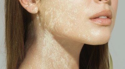 Piel resplandenciente, con Instimed