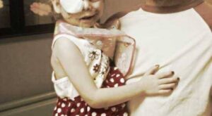 La supuesta estafa de la discriminación de KFC a una niña con la cara desfigurada