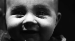 ¡OJO! Así es tu piel bajo la mirada del sol