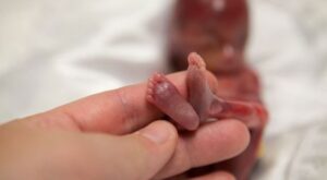Las impactantes fotos de un bebé de 19 semanas reabren el debate sobre el aborto