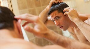 Mitos y verdades sobre el injerto capilar