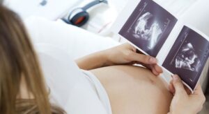 [Vídeo] Un bebé sorprende a sus padres aplaudiendo en la ecografía