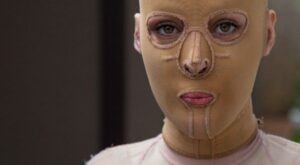 La increíble historia de Dana, la joven que descubre su rostro dos años después de que se lo quemasen