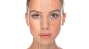 #YouLookDisgusting, belleza más allá del acné