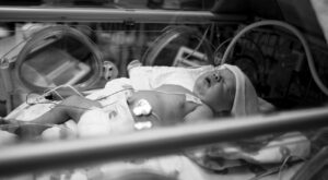 17 retratos del antes y el después de bebés prematuros que sobrevivieron a las adversidades