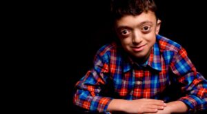 Las fotografías de niños con enfermedades raras que nos enseñan a mirar más allá de su condición