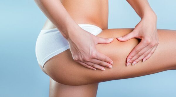 Yesoterapia: una nueva forma de combatir la celulitis