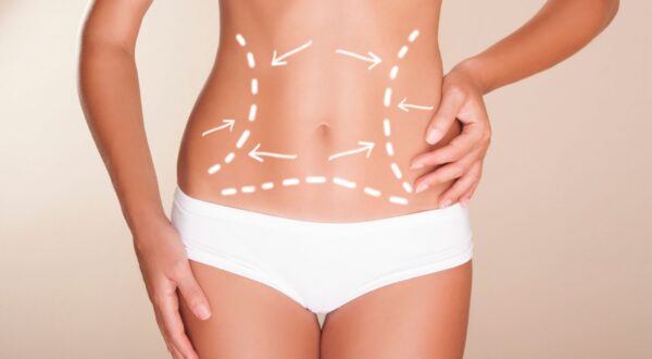 La importancia del postoperatorio tras una liposucción