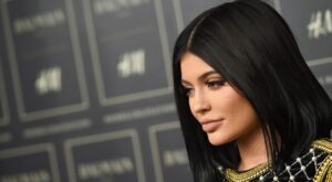 ¡Besitos de silicona! Famosas antes y después de operarse los labios