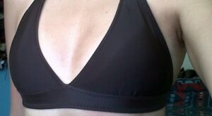 Protegido: Mamoplastia de aumento 400cc, submuscular, perfil extra alto,Cereform