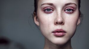 El lado emocional de la dermatología. ¿Cómo nos afectan los problemas de la piel?